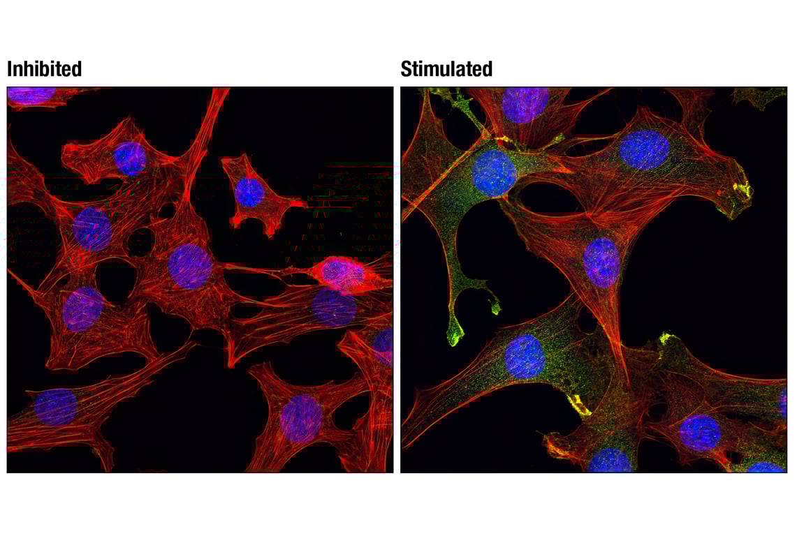 Immunofluorescence Image 1: Phospho-Akt (Ser473) (193H12) Rabbit mAb (BSA and Azide Free)