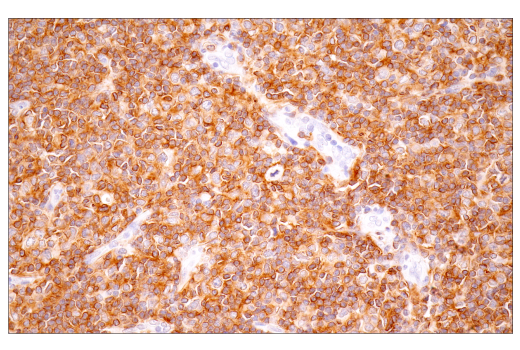 Immunohistochemistry Image 2: TNFRSF13C/BAFF-R (E3C1Q) XP<sup>®</sup> Rabbit mAb