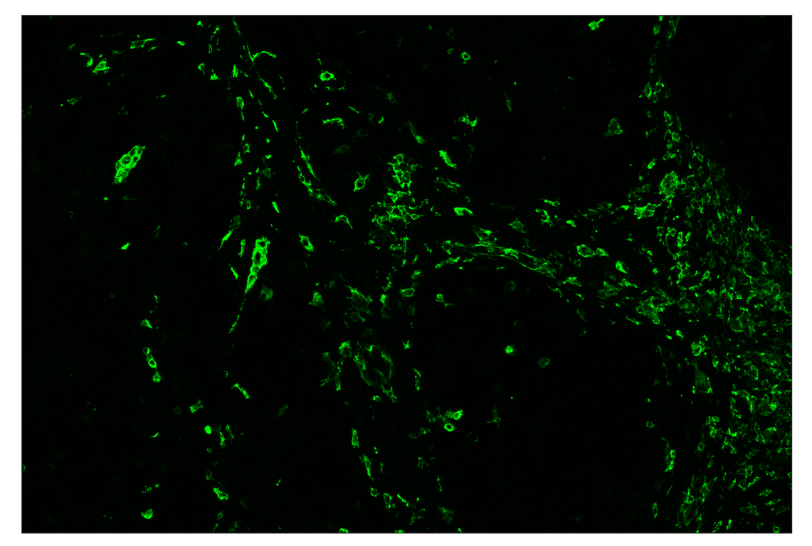 Immunohistochemistry Image 2: CD206/MRC1 (E2L9N) & CO-0035-594 SignalStar<sup>™</sup> Oligo-Antibody Pair