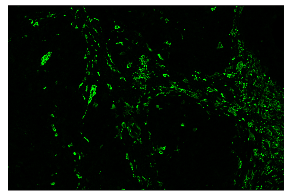 Immunohistochemistry Image 2: CD206/MRC1 (E2L9N) & CO-0035-488 SignalStar<sup>™</sup> Oligo-Antibody Pair