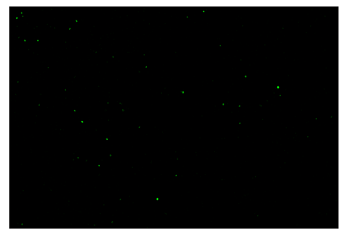 Immunohistochemistry Image 2: Granzyme B (E5V2L) & CO-0049-647 SignalStar<sup>™</sup> Oligo-Antibody Pair