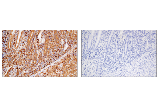 undefined Image 43: Late-Onset Alzheimer's Disease Risk Gene Antibody Sampler Kit