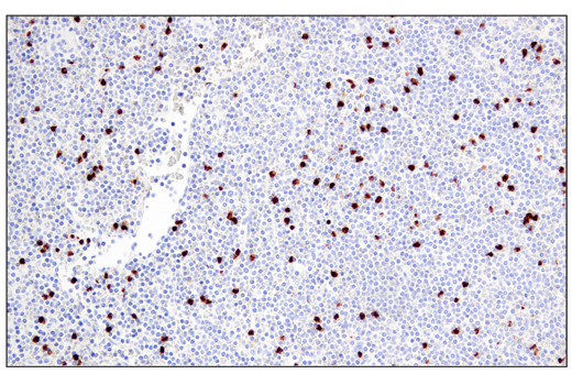 Immunohistochemistry Image 2: Arginase-1 (E4U1I) Mouse mAb (BSA and Azide Free)