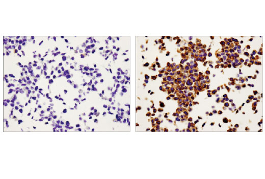 Immunohistochemistry Image 1: MMP-9 (D6O3H) XP<sup>®</sup> Rabbit mAb (BSA and Azide Free)