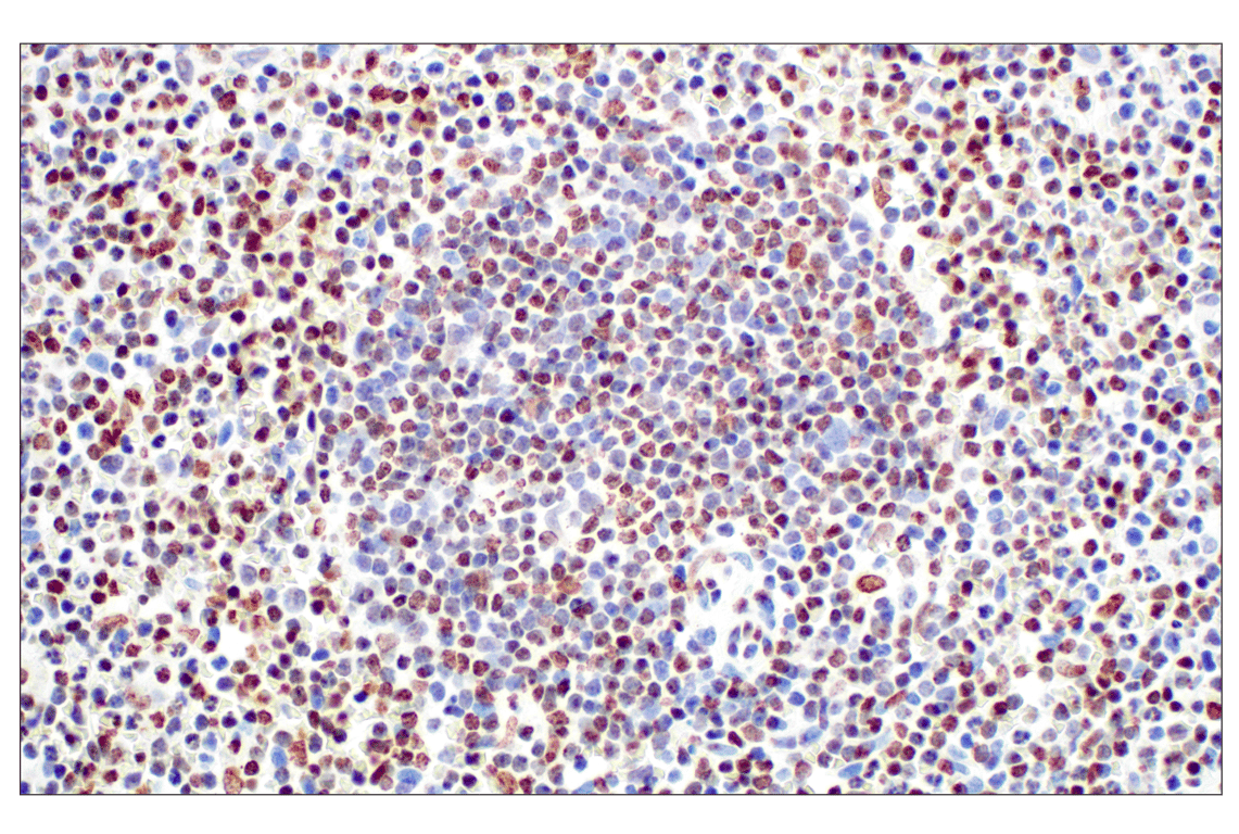 Immunohistochemistry Image 4: Tri-Methyl-Histone H3 (Lys27) (C36B11) Rabbit mAb