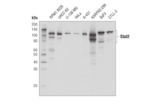 Western Blotting Image 1: Stat2 (D9J7L) Rabbit mAb (BSA and Azide Free)