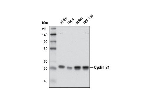 Cell Cycle Regulation Antibody Sampler Kit II: Image 1