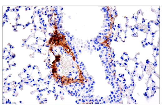 Immunohistochemistry Image 3: COL1A1 (E8F4L) XP<sup>®</sup> Rabbit mAb (BSA and Azide Free)