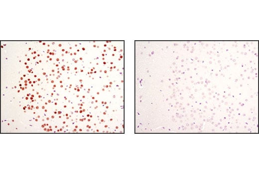 Immunohistochemistry Image 2: MeCP2 (D4F3) XP<sup>®</sup> Rabbit mAb