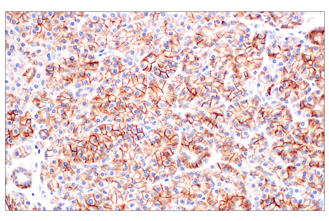 Immunohistochemistry Image 8: TACSTD2/TROP2 (F4W4J) Rabbit mAb (BSA and Azide Free)