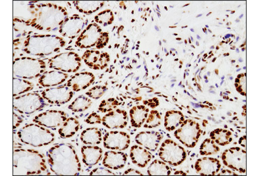 undefined Image 39: BAF Complex IHC Antibody Sampler Kit