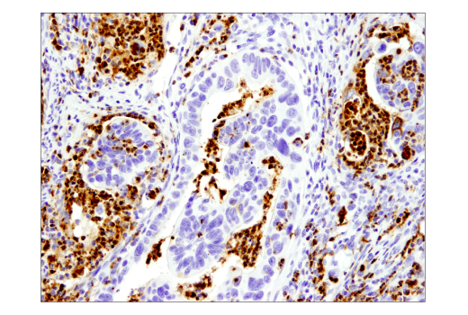 Immunohistochemistry Image 1: Myeloperoxidase (E1E7I) XP<sup>®</sup> Rabbit mAb (BSA and Azide Free)