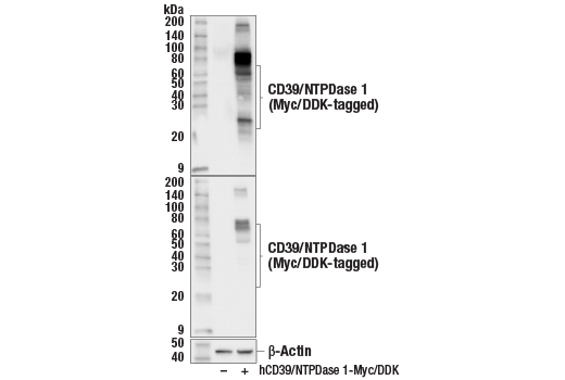 Western Blotting Image 2: CD39/NTPDase 1 (E5A6L) Rabbit mAb