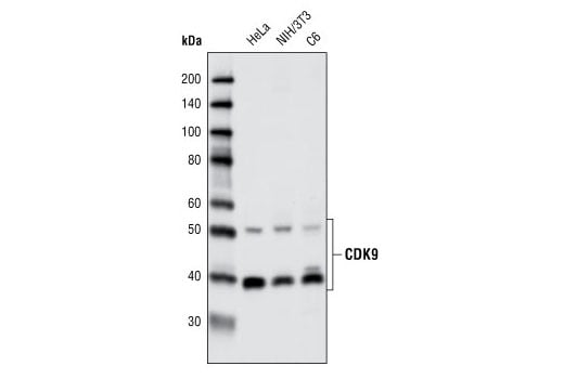Western Blotting Image 1: CDK9 (C12F7) Rabbit mAb (BSA and Azide Free)