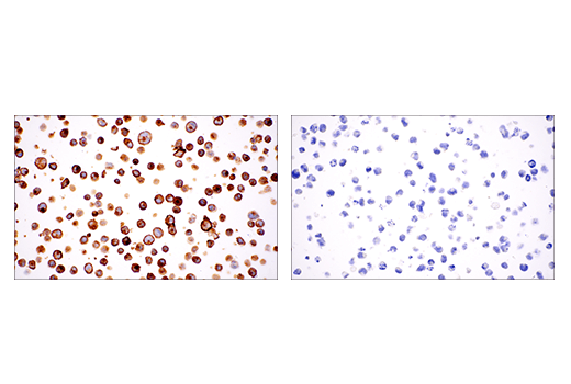 Immunohistochemistry Image 1: CD22 (E7L6Z) XP<sup>®</sup> Rabbit mAb (BSA and Azide Free)