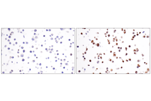 Immunohistochemistry Image 9: HIF-1α (E1V6A) Rabbit mAb