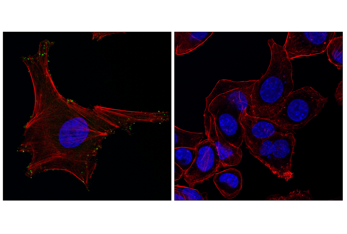 Immunofluorescence Image 1: MYO10 (F3V7U) Rabbit mAb