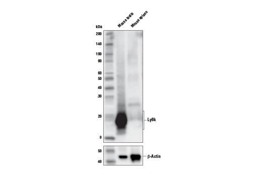 Western Blotting Image 1: Ly6k (E4K8Y) XP<sup>®</sup> Rabbit mAb (BSA and Azide Free)