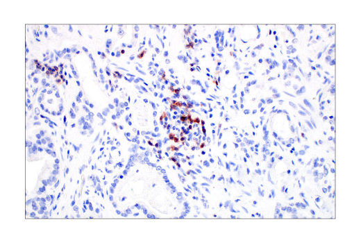 undefined Image 82: Human Exhausted CD8<sup>+</sup> T Cell IHC Antibody Sampler Kit