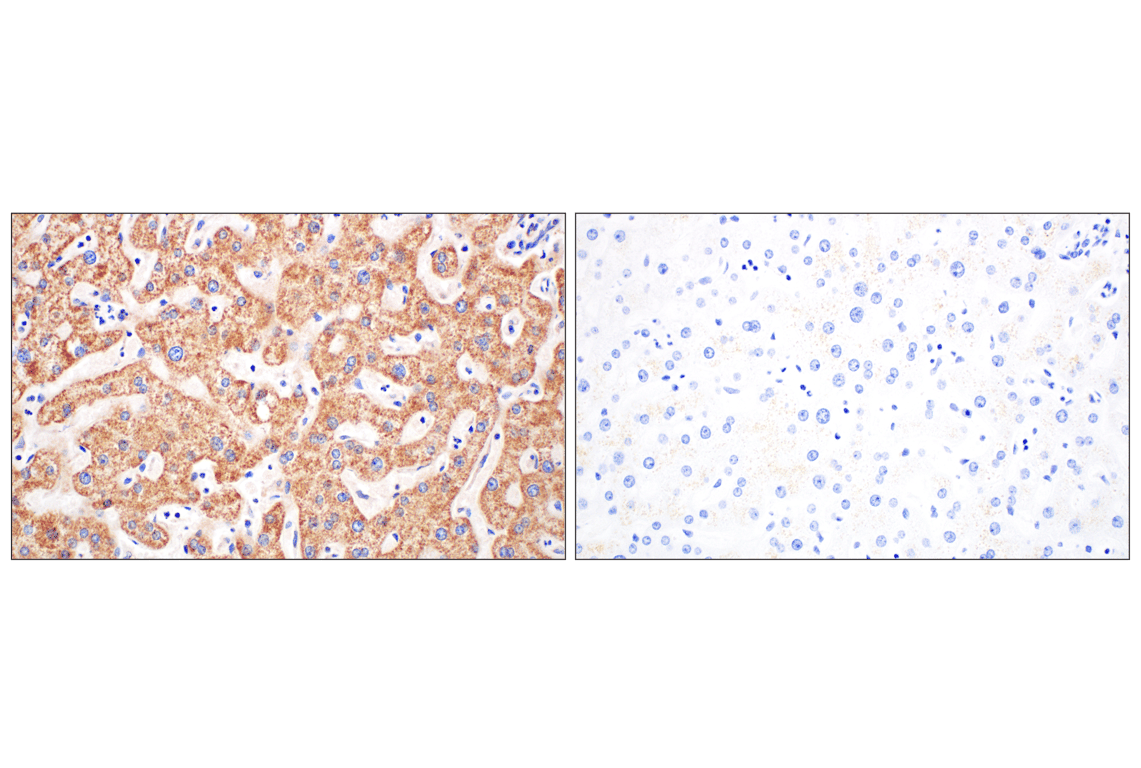 Immunohistochemistry Image 8: GCDH (F2P2M) Rabbit mAb