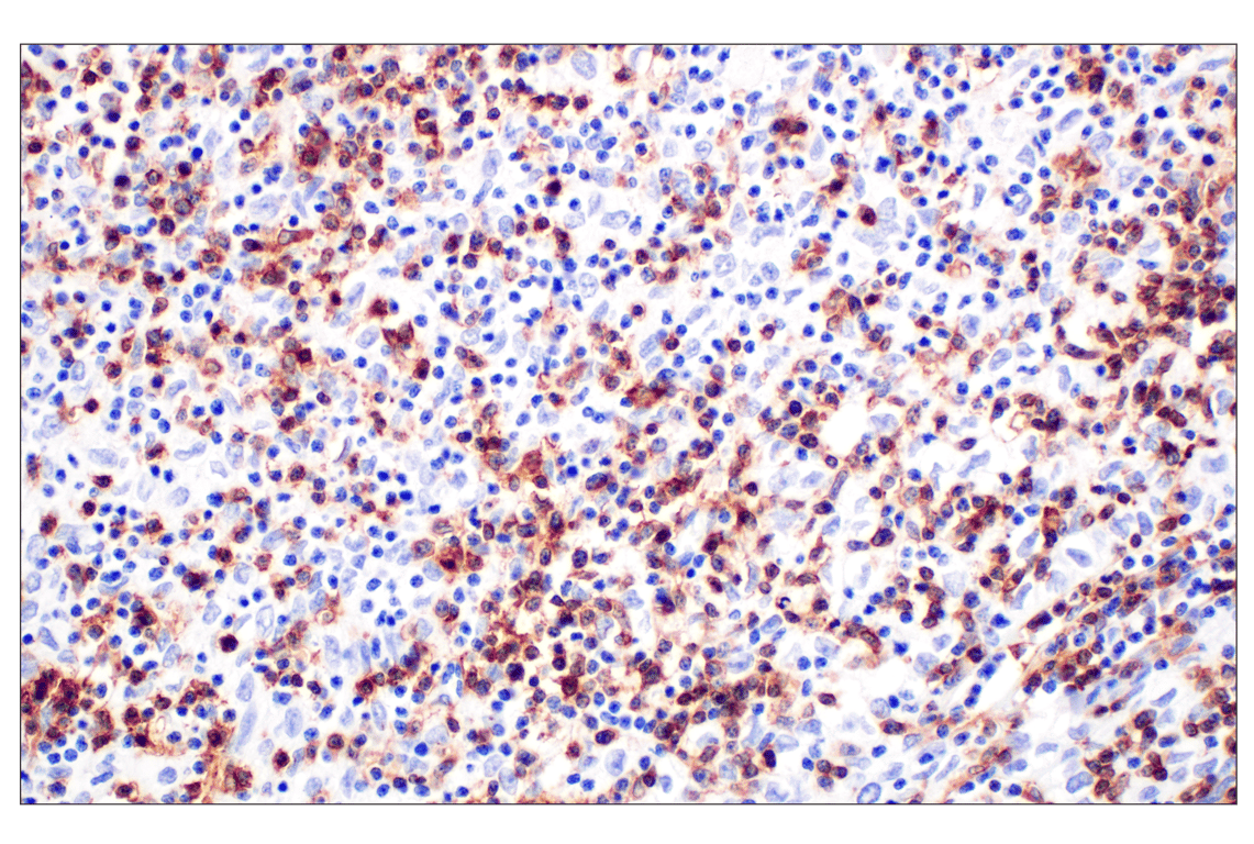 Immunohistochemistry Image 1: CD4 (MSVA-004R) Rabbit mAb