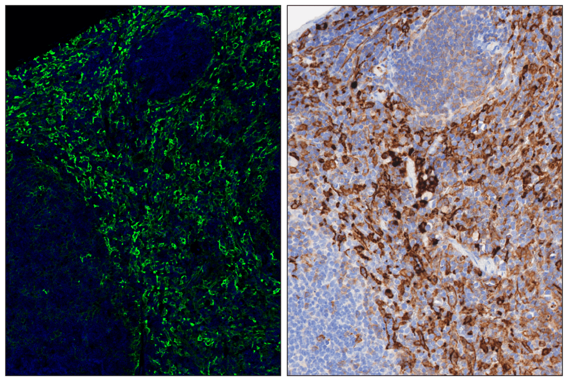 Immunohistochemistry Image 6: CD206/MRC1 (E6T5J) & CO-0032-594 SignalStar<sup>™</sup> Oligo-Antibody Pair