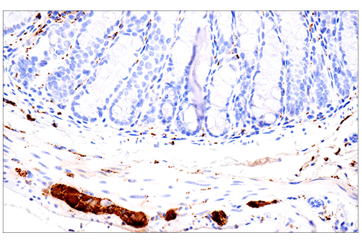 Immunohistochemistry Image 12: Calretinin (E7R6O) XP<sup>®</sup> Rabbit mAb