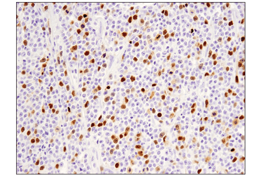 Immunohistochemistry Image 4: PAF15 (D8E2Y) XP<sup>®</sup> Rabbit mAb