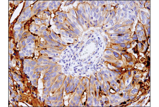 Immunohistochemistry Image 3: Mesothelin (D9R5G) XP<sup>®</sup> Rabbit mAb (BSA and Azide Free)