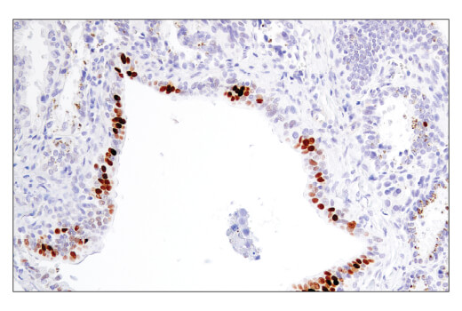 Immunohistochemistry Image 1: BCL6 (E5I8I) Rabbit mAb