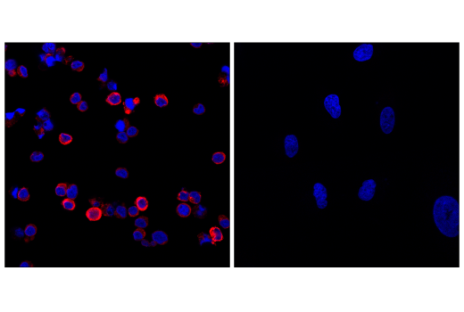 Immunofluorescence Image 1: STING (E9X7F) Rabbit mAb (Alexa Fluor<sup>®</sup> 647 Conjugate)