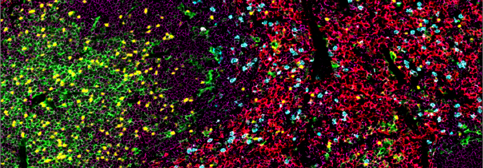 SignalStar™ multiplex immunohistochemical analysis of paraffin-embedded mouse spleen using CD45 (D3F8Q) & CO-0046-488 SignalStar™ Oligo-Antibody Pair #72790 (magenta), FoxP3 (D6O8R) & CO-0041-647 SignalStar™ Oligo-Antibody Pair #45142 (yellow), Ly-6G (E6Z1T) & CO-0053-750 SignalStar™ Oligo-Antibody Pair #64664 (cyan), CD8α (D4W2Z) & CO-0040-594 SignalStar™ Oligo-Antibody Pair #39714 (green), F4/80 (D2S9R) & CO-0042-488 SignalStar™ Oligo-Antibody Pair #95804 (red), and Granzyme B (E5V2L) & CO-0049-647 SignalStar™ Oligo-Antibody Pair #98534 (white). 所有荧光团都被分配了伪彩，如图所示。在 Leica Biosystems 的 BOND RX 自动染色机上进行染色。