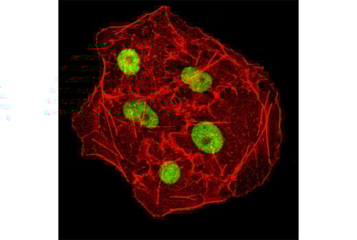 Immunofluorescence Image 1: DNMT1 (D63A6) XP<sup>®</sup> Rabbit mAb (BSA and Azide Free)