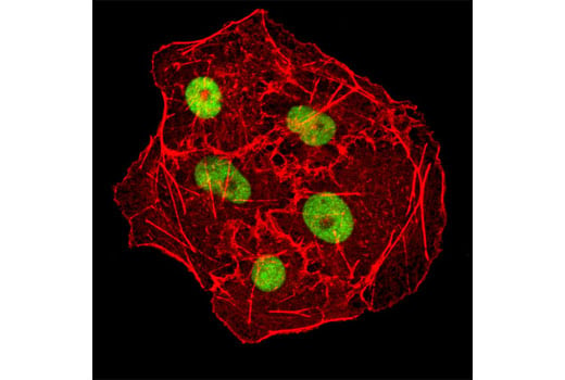 Immunofluorescence Image 1: DNMT1 (D63A6) XP<sup>®</sup> Rabbit mAb (BSA and Azide Free)