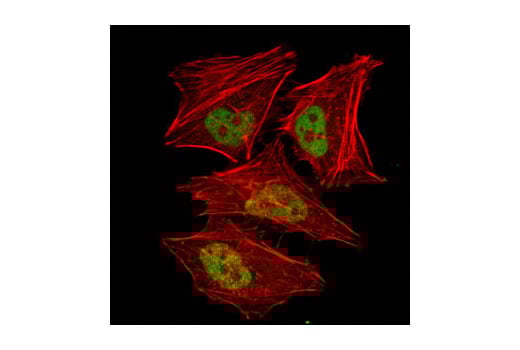 Immunofluorescence Image 1: GCN5L2 (C26A10) Rabbit mAb