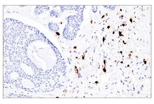 Immunohistochemistry Image 3: CD38 (E7Z8C) XP<sup>®</sup> Rabbit mAb