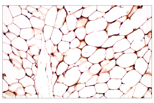 Immunohistochemistry Image 2: CD36 (E8B7S) Rabbit mAb