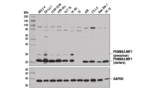 Western Blotting Image 1: PSMB8/LMP7 (D1K7X) Rabbit mAb