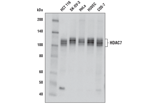 Western Blotting Image 1: HDAC7 (E7O8V) Rabbit mAb