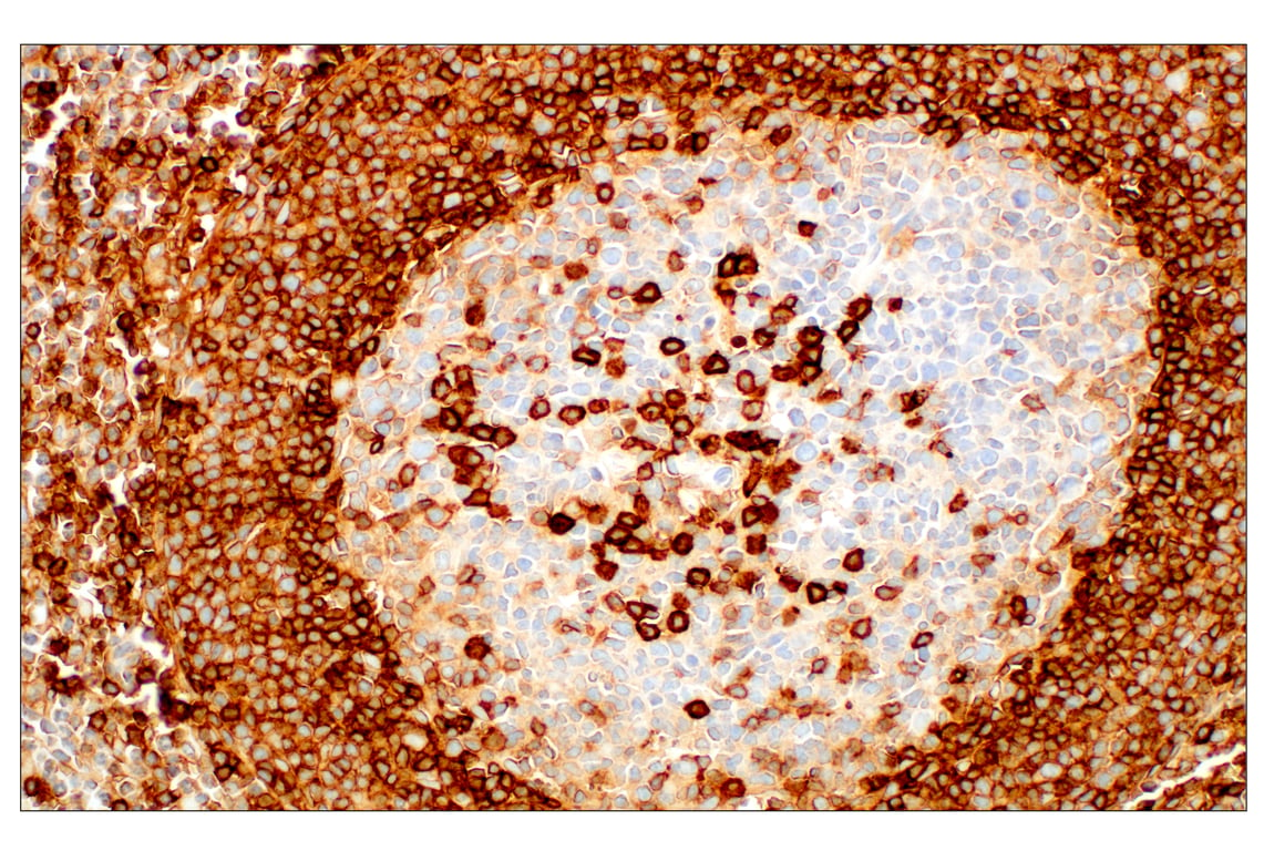 Immunohistochemistry Image 8: CD38 (E7Z8C) XP<sup>®</sup> Rabbit mAb (BSA and Azide Free)