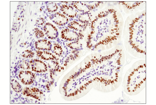 Immunohistochemistry Image 4: LRF/Pokemon (D7U2O) Rabbit mAb