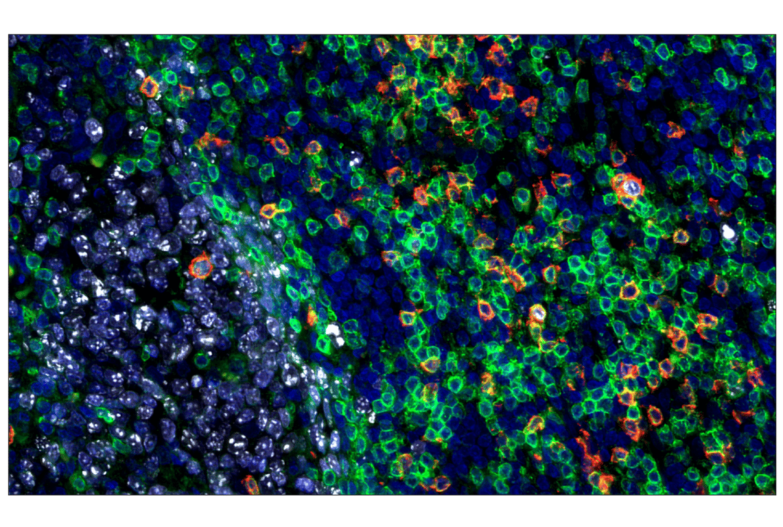 Immunohistochemistry Image 2: Ki-67 (D2H10) Rabbit mAb (Alexa Fluor<sup>®</sup> 555 Conjugate)