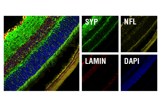 Immunofluorescence Image 1: Synaptophysin (D8F6H) XP<sup>®</sup> Rabbit mAb (BSA and Azide Free)