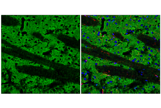 Immunofluorescence Image 1: α-Synuclein (E4U2F) XP<sup>®</sup> Rabbit mAb (BSA and Azide Free)