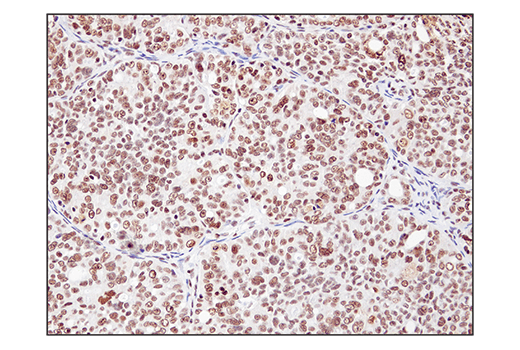 undefined Image 41: BAF Complex IHC Antibody Sampler Kit