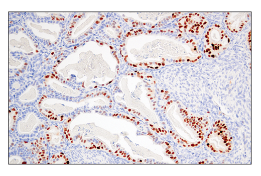 Immunohistochemistry Image 1: Cyclin D1 (E3P5S) XP<sup>®</sup> Rabbit mAb (BSA and Azide Free)