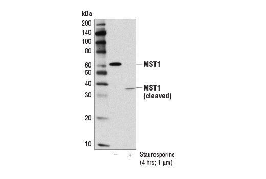 undefined Image 11: Hippo Pathway: Upstream Signaling Antibody Sampler Kit
