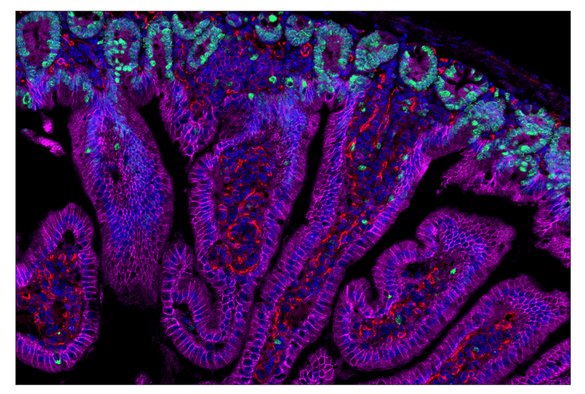 Immunohistochemistry Image 1: Ki-67 (D3B5) & CO-0052-750 SignalStar<sup>™</sup> Oligo-Antibody Pair