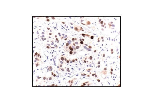 undefined Image 4: PhosphoPlus<sup>®</sup> p53 (Ser15) Antibody Duet