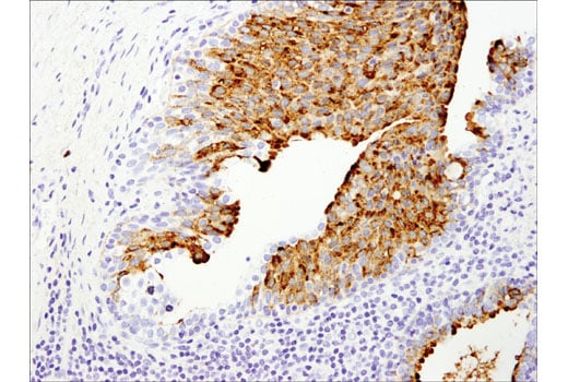 Immunohistochemistry Image 5: OLFM4 (D1E4M) XP<sup>®</sup> Rabbit mAb
